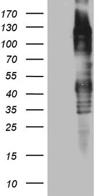 TTC14 Mouse Monoclonal Antibody (Biotin conjugated) [Clone ID: OTI1G9] - image 1
