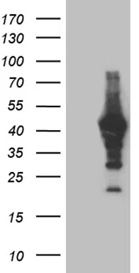 MAGEB4 Mouse Monoclonal Antibody (Biotin conjugated) [Clone ID: OTI1C7] - image 1
