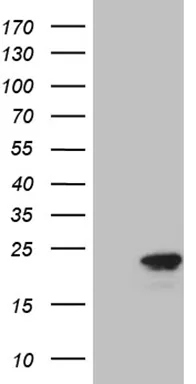 p16INK4A (CDKN2A) Mouse Monoclonal Antibody (HRP conjugated) [Clone ID: OTI4E11] - image 1