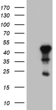 ESE1 (ELF3) Mouse Monoclonal Antibody (Biotin conjugated) [Clone ID: OTI4G5] - image 1
