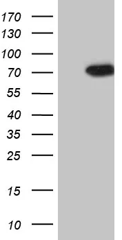 PIP5K3 (PIKFYVE) Mouse Monoclonal Antibody (HRP conjugated) [Clone ID: OTI1D2] - image 1