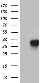 CD79B Mouse Monoclonal Antibody (Biotin conjugated) [Clone ID: OTI7F8] - image 1