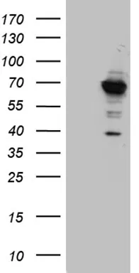 GNPAT Mouse Monoclonal Antibody (HRP conjugated) [Clone ID: OTI2F8] - image 1