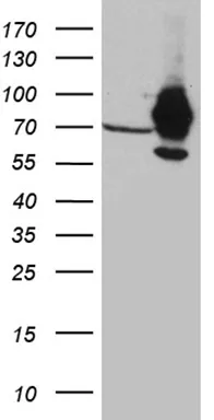 IMP3 (IGF2BP3) Mouse Monoclonal Antibody (Biotin conjugated) [Clone ID: OTI7B10] - image 1