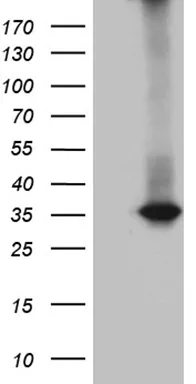 RWDD3 Mouse Monoclonal Antibody (Biotin conjugated) [Clone ID: OTI8B3] - image 1