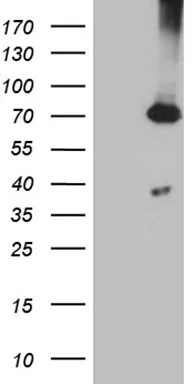 PGM2L1 Mouse Monoclonal Antibody (Biotin conjugated) [Clone ID: OTI1C2] - image 1
