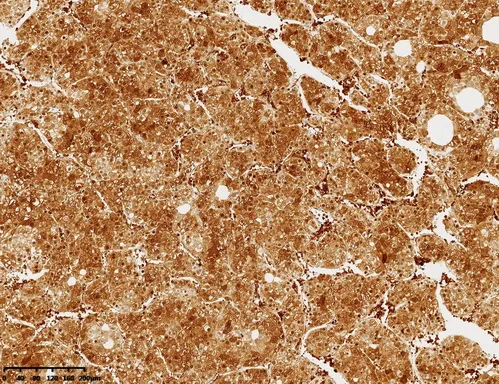 Arginase 1 (ARG1) Mouse Monoclonal Antibody (Biotin conjugated) [Clone ID: OTI2E7] - image 1