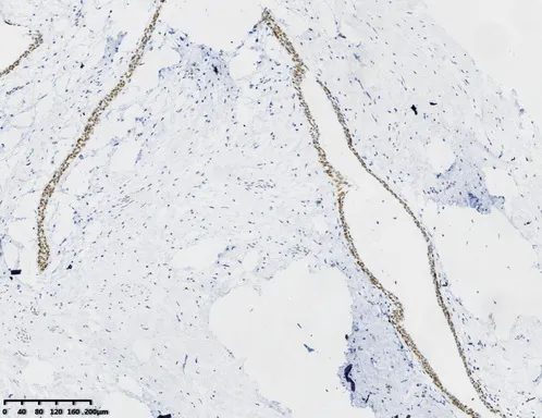 FOXP1 Mouse Monoclonal Antibody [Clone ID: OTI2H3] - image 1