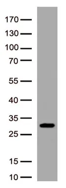 Nav1.5 (SCN5A) Mouse Monoclonal Antibody [Clone ID: OTI5E9] - image 1