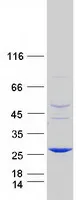 ABHD14B (NM_032750) Human Recombinant Protein - image 1