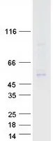 DP1 (TFDP1) (NM_007111) Human Recombinant Protein - image 1