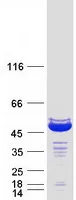 HOMER3 (NM_004838) Human Recombinant Protein - image 1