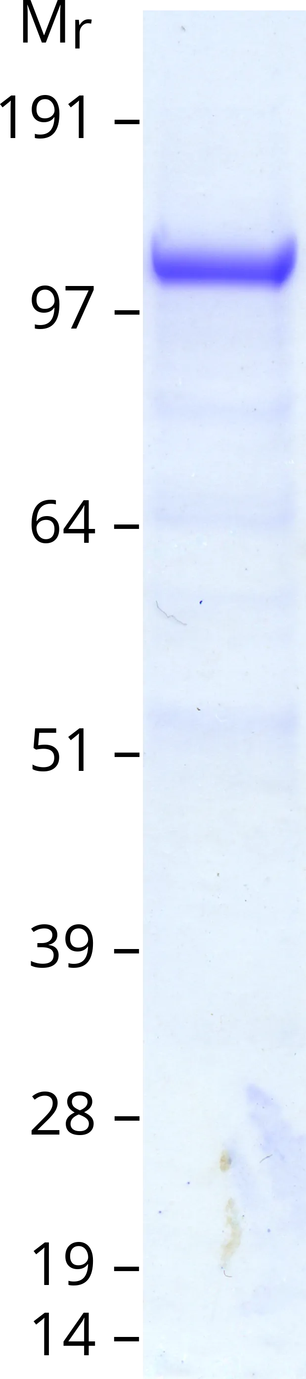 TYK2 (NM_003331) Human Recombinant Protein - image 1