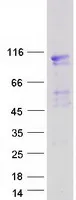 EVI5L (NM_145245) Human Recombinant Protein - image 1