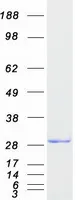 CENPH (NM_022909) Human Recombinant Protein - image 1