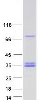 CFHL2 (CFHR2) (NM_005666) Human Recombinant Protein - image 1