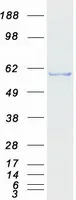 IPPK (NM_022755) Human Recombinant Protein - image 1
