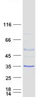 RAB40B (NM_006822) Human Recombinant Protein - image 1