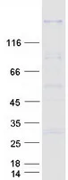 ITPRID2 (NM_006751) Human Recombinant Protein - image 1