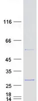RPL18 (NM_000979) Human Recombinant Protein - image 1