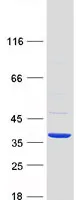 RDHE2 (SDR16C5) (NM_138969) Human Recombinant Protein - image 1