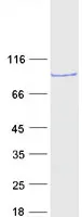 SMYD4 (NM_052928) Human Recombinant Protein - image 1