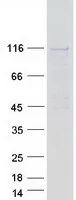 SAPS2 (PPP6R2) (NM_014678) Human Recombinant Protein - image 1