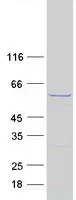 CESK1 (CCT8L2) (NM_014406) Human Recombinant Protein - image 1