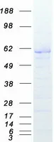 XIAP (NM_001167) Human Recombinant Protein - image 1