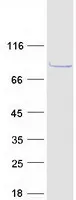 CABS1 (NM_033122) Human Recombinant Protein - image 1