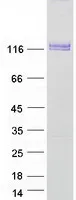DDR2 (NM_001014796) Human Recombinant Protein - image 1