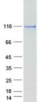 CC2D1A (NM_017721) Human Recombinant Protein - image 1