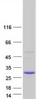 SSPN (NM_005086) Human Recombinant Protein - image 1
