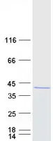 PRMT6 (NM_018137) Human Recombinant Protein - image 1