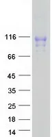 SLITL2 (VASN) (NM_138440) Human Recombinant Protein - image 1