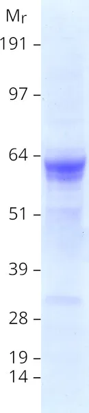 Alkaline Phosphatase (ALPP) (NM_001632) Human Recombinant Protein - image 1