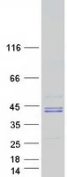 HLAB (HLA-B) (NM_005514) Human Recombinant Protein - image 1