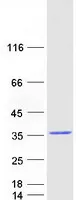 RAB9B (NM_016370) Human Recombinant Protein - image 1