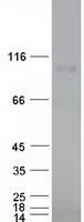 CelluLar Apoptosis Susceptibility (CSE1L) (NM_001316) Human Recombinant Protein - image 1
