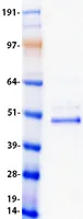 CHX10 (VSX2) (NM_182894) Human Recombinant Protein - image 1