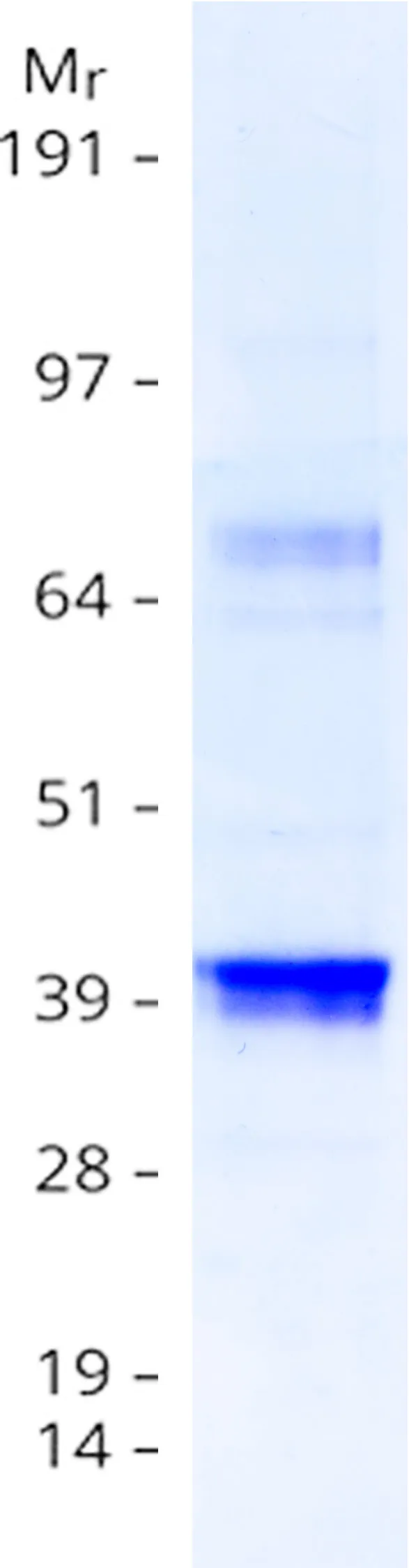 HSD11B1 (NM_181755) Human Recombinant Protein - image 1