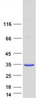 SuLT1A1 (NM_177534) Human Recombinant Protein - image 1