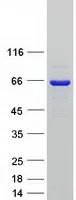 SETD3 (NM_032233) Human Recombinant Protein - image 1