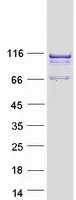 SPAG1 (NM_003114) Human Recombinant Protein - image 1