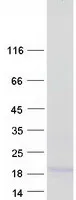 MRAP (NM_206898) Human Recombinant Protein - image 1