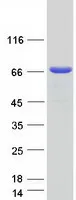 TFIIE alpha (GTF2E1) (NM_005513) Human Recombinant Protein - image 1