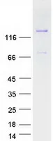 MAGI3 (NM_152900) Human Recombinant Protein - image 1