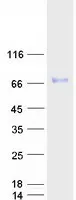 SPINT1 (NM_181642) Human Recombinant Protein - image 1