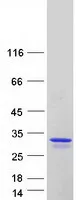 TCF21 (NM_198392) Human Recombinant Protein - image 1