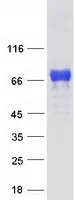PmL Protein (PmL) (NM_033244) Human Recombinant Protein - image 1